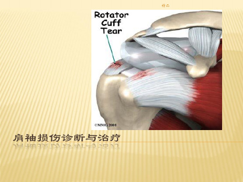 肩袖损伤的治疗-医学演示课件-精选.ppt