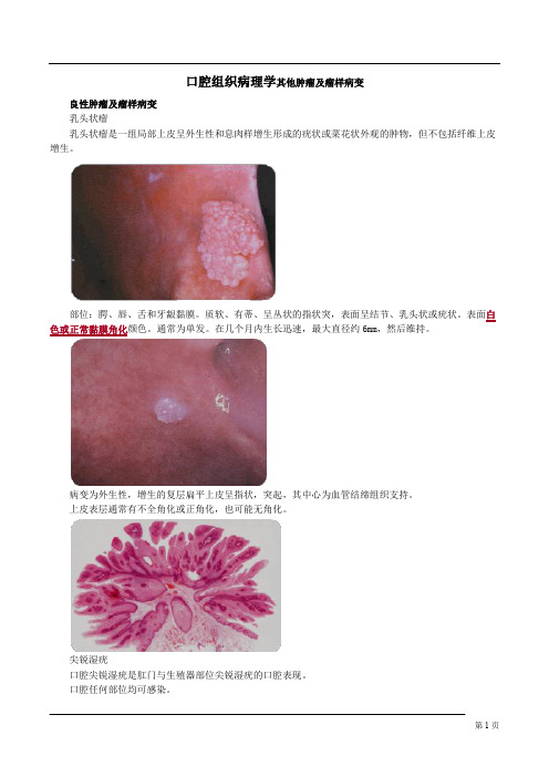 口腔组织病理学其他肿瘤及瘤样病变