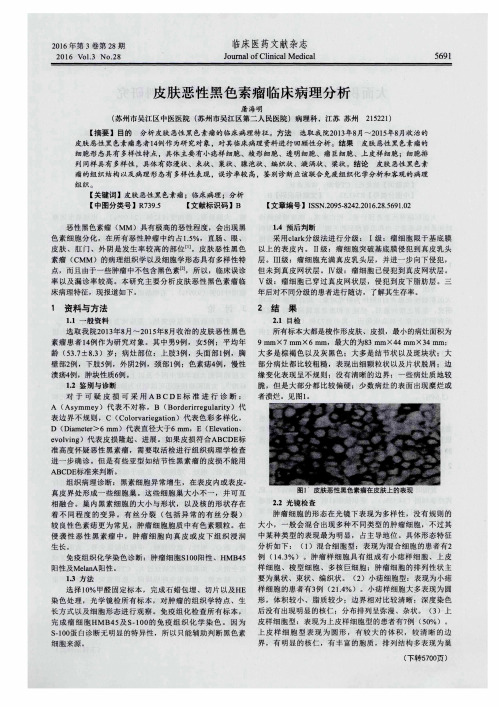 皮肤恶性黑色素瘤临床病理分析