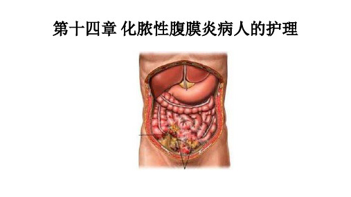 急性化脓性腹膜炎病人的.护理