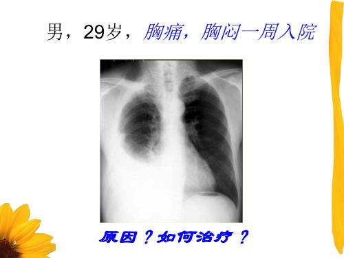 胸腔积液实验室检查-