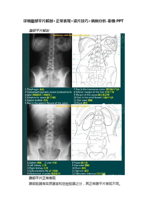 详细腹部平片解剖+正常表现+读片技巧+病例分析–影像PPT