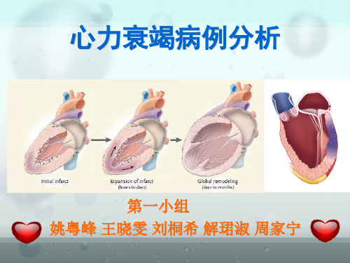 心力衰竭病例分析