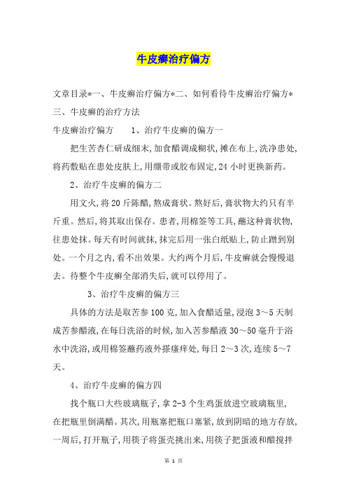 牛皮癣治疗偏方1