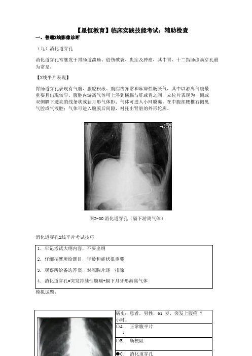 实践技能辅助检查之普通X线影像诊断(九)消化道穿孔[临床实践技能考试]