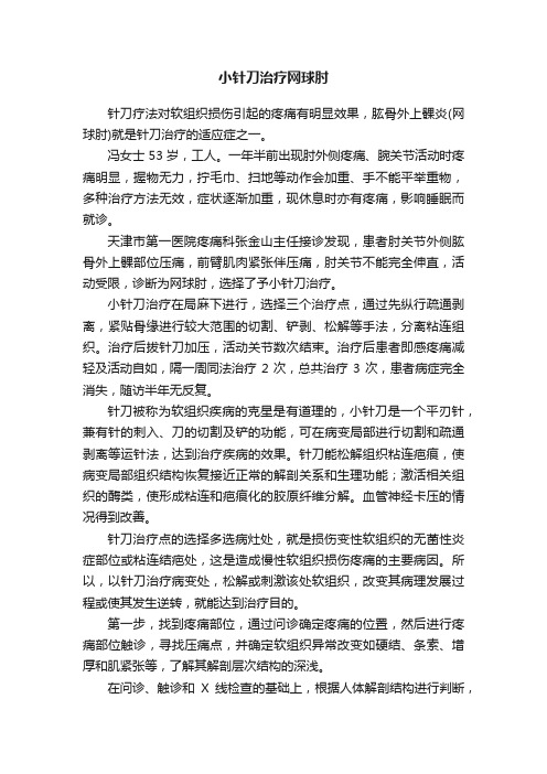 小针刀治疗网球肘