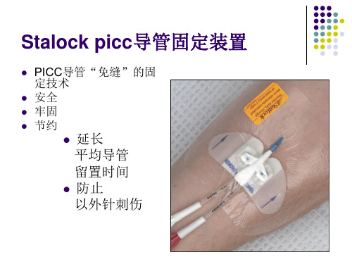 Stalock picc导管固定装置(思乐扣)