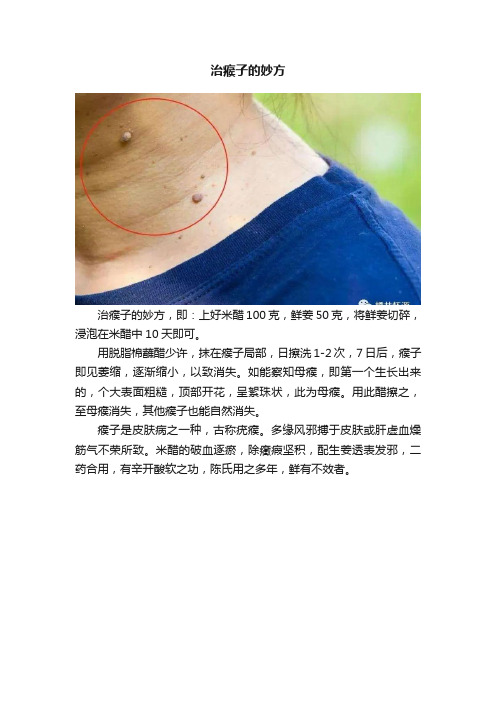 治瘊子的妙方