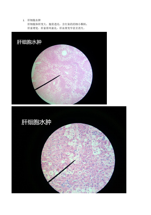 病理学 镜下切片