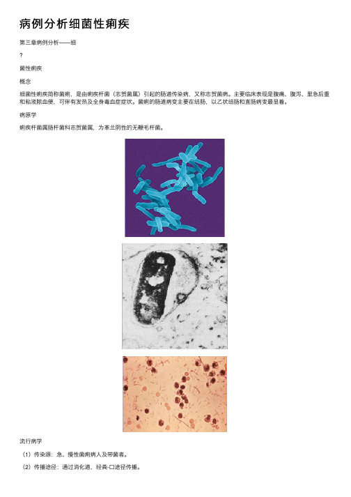 病例分析细菌性痢疾