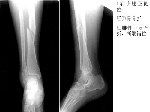 医学影像学读片考试资料