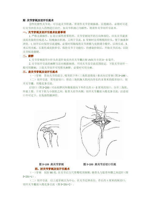 穿刺术