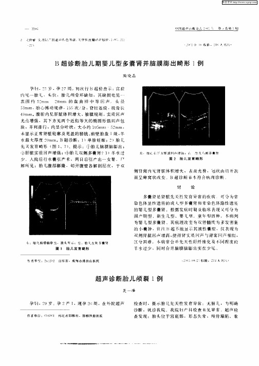 超声诊断胎儿颅裂1例