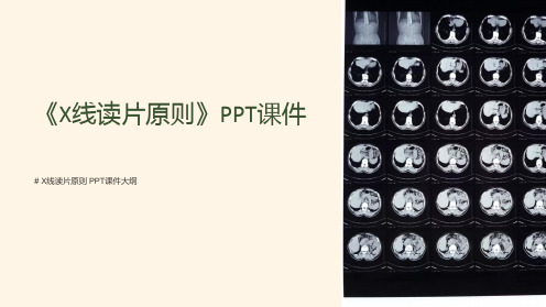 《x线读片原则》课件