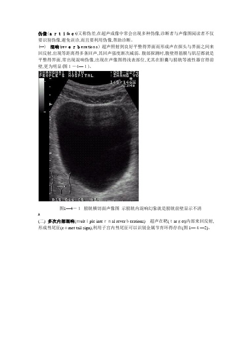 超声伪像