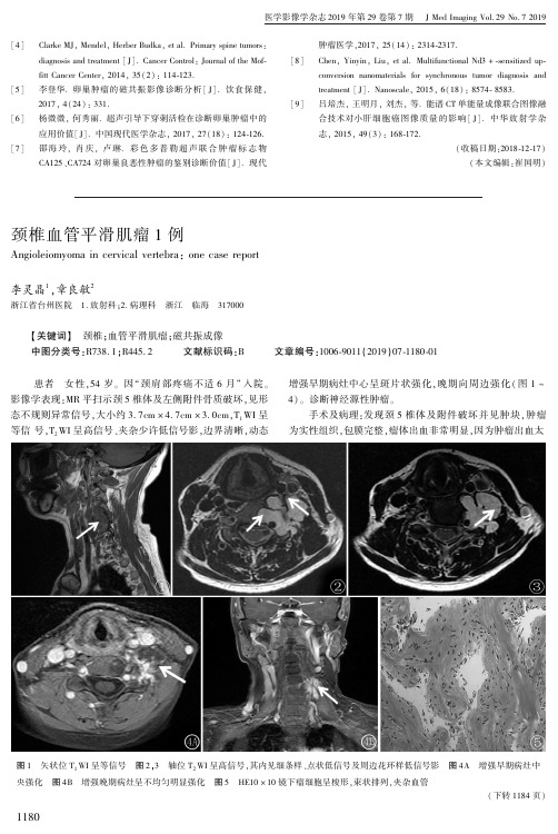颈椎血管平滑肌瘤1例