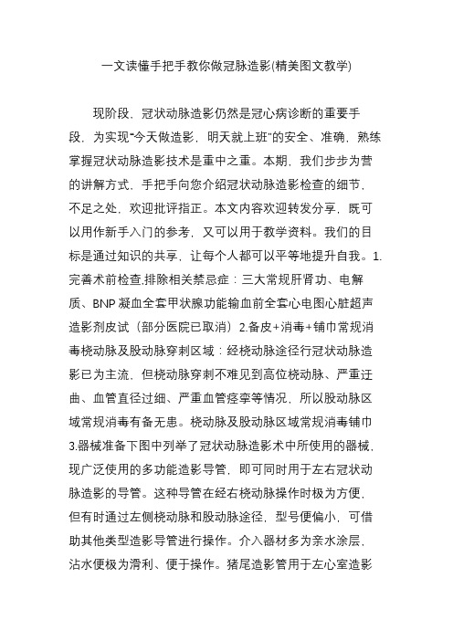 一文读懂手把手教你做冠脉造影(精美图文教学)