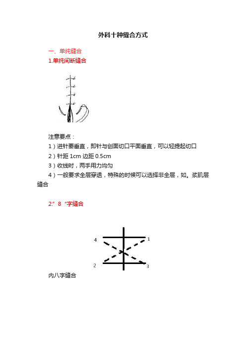 外科十种缝合方式