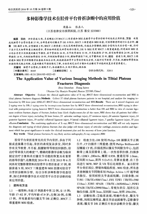 多种影像学技术在胫骨平台骨折诊断中的应用价值