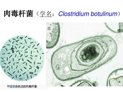 肉毒杆菌