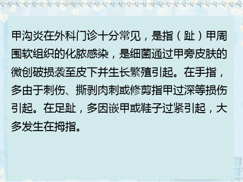 甲沟炎治疗的护理与预防17页PPT文档