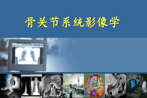精品推荐医学影像诊断图文详解完整版-骨关节系统影像学