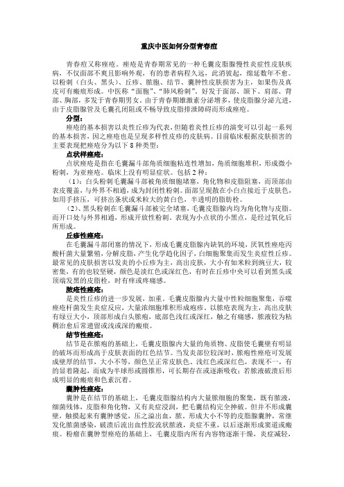 重庆中医如何分型青春痘