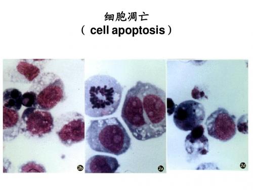 细胞凋亡