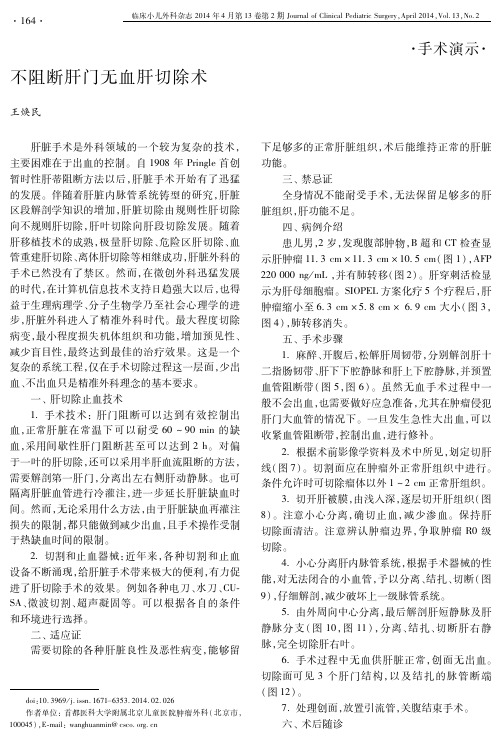 不阻断肝门无血肝切除术