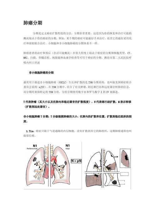 肺癌分期(图片)