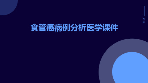 食管癌病例分析医学课件