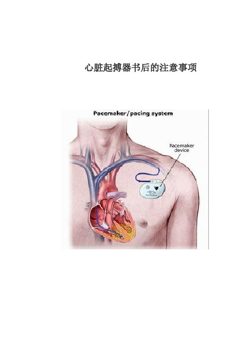 在安装了起搏器后