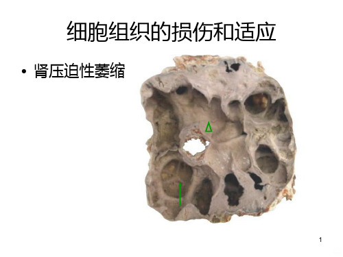 病理大体标本PPT课件