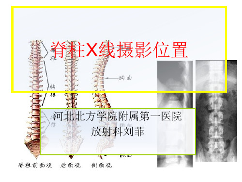 脊柱X线摄影技术PPT课件