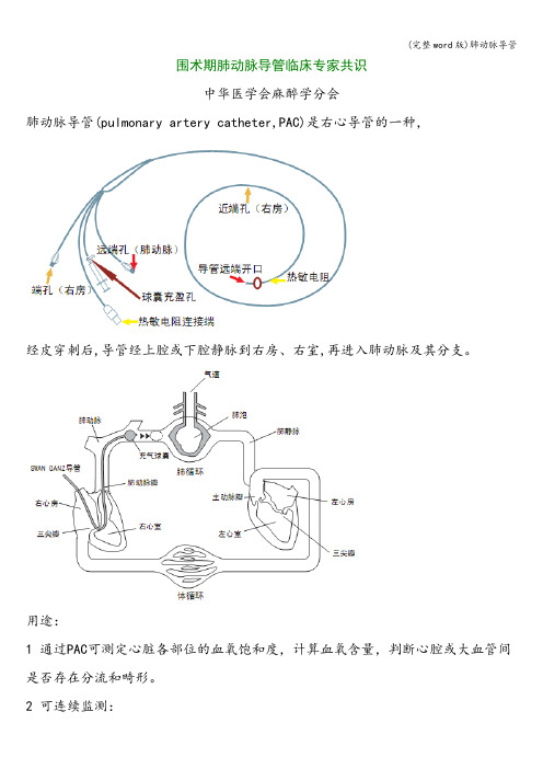 (完整word版)肺动脉导管