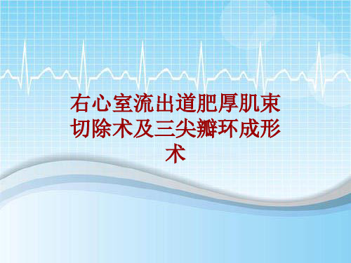 手术讲解模板：右心室流出道肥厚肌束切除术及三尖瓣环成形术