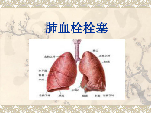 肺栓塞(讲课教学课件).ppt