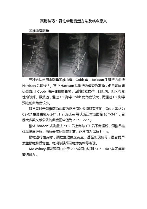 实用技巧：脊柱常用测量方法及临床意义