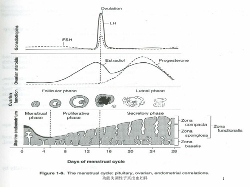 功能失调性子宫出血妇科培训课件