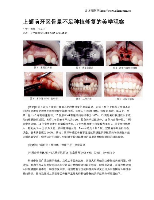 上颌前牙区骨量不足种植修复的美学观察