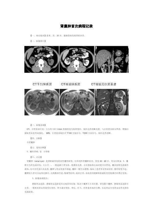 肾囊肿首次病程记录