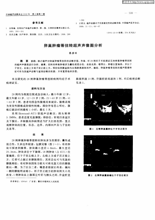 卵巢肿瘤蒂扭转超声声像图分析