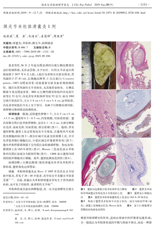 踝关节米粒体滑囊炎1例