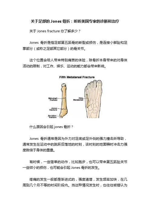 关于足部的Jones骨折：听听美国专家的诊断和治疗