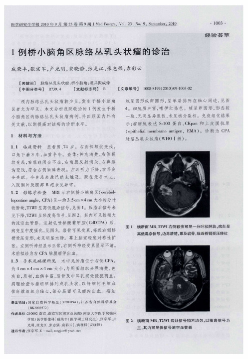 1例桥小脑角区脉络丛乳头状瘤的诊治