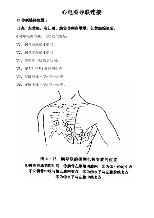 12、18导联连接位置图示