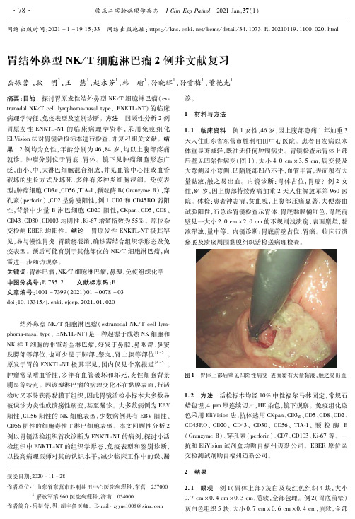 胃结外鼻型NKT细胞淋巴瘤2例并文献复习