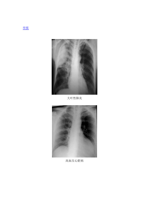 胸部X线片系统读片原理