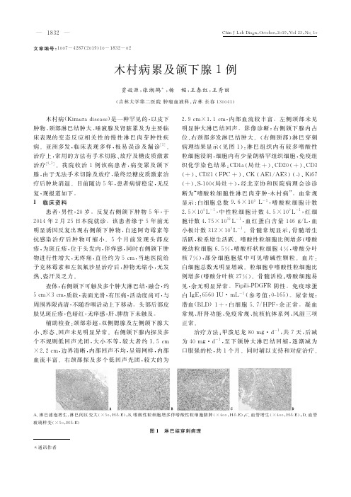 木村病累及颌下腺1例