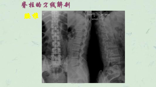 腰椎影像解剖学课件